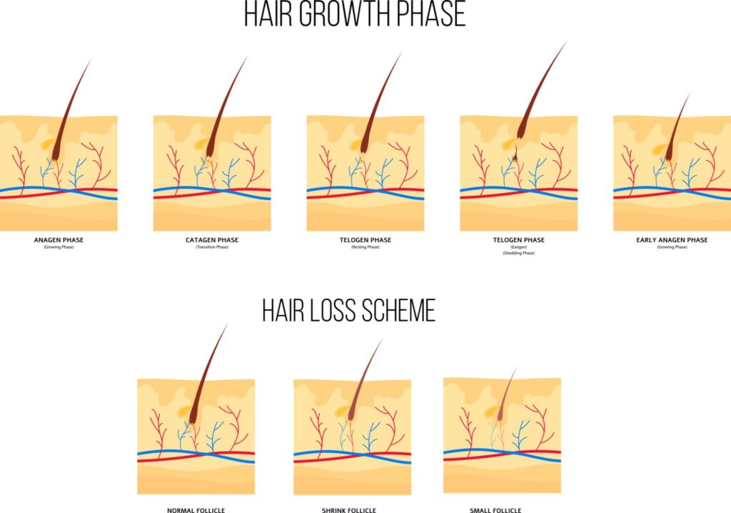 Best Alternative of Minoxidil: